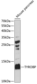 Western blot analysis of extracts of mouse pancreas, using TYROBP antibody (TA382976) at 1:3000 dilution. - Secondary antibody: HRP Goat Anti-Rabbit IgG (H+L) at 1:10000 dilution. - Lysates/proteins: 25ug per lane. - Blocking buffer: 3% nonfat dry milk in TBST. - Detection: ECL Basic Kit . - Exposure time: 90s.