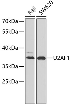 Immunofluorescence of Rho using a dilution of Rhodopsin antibody