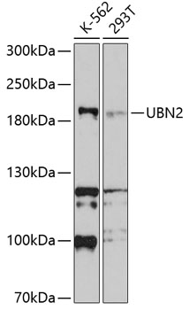 Western Blot: Sodium / Hydrogen Exchanger 3 [phospho Ser552] Antibody (14D5) - Detection of NHE3 [S552] in human kidney lysate.