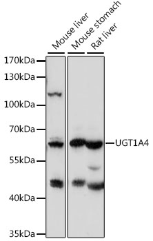 Western blot - Anti-Plasma Kallikrein 1B antibody [EPR5707]; All lanes : Anti-Plasma Kallikrein 1B antibody [EPR5707] at 1/1000 dilution.Lane 1 : Human breast cancer lysate.Lane 2 : Human plasma lysate.Lane 3 : Human ovary lysate.Lane 4 : Fetal liver lysate.Lysates/proteins at 10 ug per lane.Secondary.HRP labelled Goat anti Rabbit IgG at 1/2000 dilution.Predicted band size : 71 kDa.Observed band size : 80 kDa.
