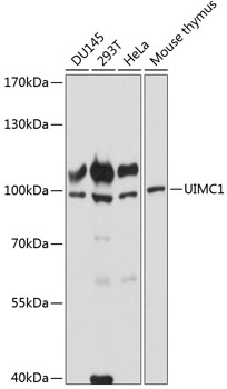 Western blot - SEPP1 antibody [EPR4614]; All lanes : Anti-SEPP1 antibody [EPR4614] at 1/1000 dilution.Lane 1 : Human heart lysate.Lane 2 : HepG2 lysate.Lane 3 : 293T lysate.Lysates/proteins at 10 ug per lane.Predicted band size : 43 kDa.