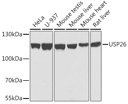 Western blot analysis of extracts of various cell lines, using USP26 antibody (TA383155) at 1:1000 dilution. - Secondary antibody: HRP Goat Anti-Rabbit IgG (H+L) at 1:10000 dilution. - Lysates/proteins: 25ug per lane. - Blocking buffer: 3% nonfat dry milk in TBST. - Detection: ECL Basic Kit . - Exposure time: 30s.