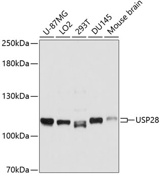 Western Blot of Mouse anti-TRPC6 Antibody Lane 1: Mouse Kidney WCL Load: 10 ug per lane Primary antibody: TRPC6 Antibody at 1:1000 for overnight at 4°C Secondary antibody: DyLight™ 649 donkey anti-mouse at 1:20,000 for 30 min at RT Block: MB-070 for 30 min at RT