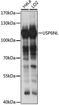 Western blot analysis of extracts of various cell lines, using USP6NL antibody (TA383173) at 1:1000 dilution. - Secondary antibody: HRP Goat Anti-Rabbit IgG (H+L) at 1:10000 dilution. - Lysates/proteins: 25ug per lane. - Blocking buffer: 3% nonfat dry milk in TBST. - Detection: ECL Basic Kit . - Exposure time: 10s.