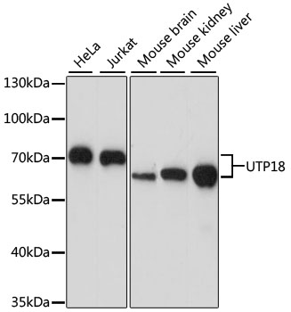 Western blot analysis of extracts of various cell lines, using UTP18 antibody (TA383180) at 1:1000 dilution. - Secondary antibody: HRP Goat Anti-Rabbit IgG (H+L) at 1:10000 dilution. - Lysates/proteins: 25ug per lane. - Blocking buffer: 3% nonfat dry milk in TBST. - Detection: ECL Basic Kit . - Exposure time: 30s.