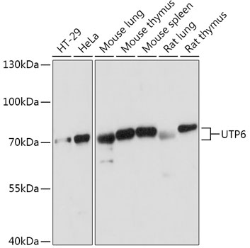 Western blot analysis of extracts of various cell lines, using UTP6 antibody (TA383181) at 1:1000 dilution. - Secondary antibody: HRP Goat Anti-Rabbit IgG (H+L) at 1:10000 dilution. - Lysates/proteins: 25ug per lane. - Blocking buffer: 3% nonfat dry milk in TBST. - Detection: ECL Basic Kit . - Exposure time: 5s.