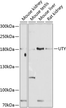 Western blot analysis of extracts of various cell lines, using UTY antibody (TA383182) at 1:1000 dilution. - Secondary antibody: HRP Goat Anti-Rabbit IgG (H+L) at 1:10000 dilution. - Lysates/proteins: 25ug per lane. - Blocking buffer: 3% nonfat dry milk in TBST. - Detection: ECL Basic Kit . - Exposure time: 60s.