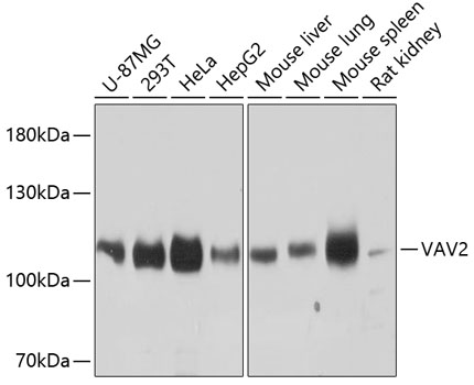 Western blot analysis of extracts of various cell lines, using VAV2 antibody (TA383202) at 1:3000 dilution. - Secondary antibody: HRP Goat Anti-Rabbit IgG (H+L) at 1:10000 dilution. - Lysates/proteins: 25ug per lane. - Blocking buffer: 3% nonfat dry milk in TBST. - Detection: ECL Basic Kit . - Exposure time: 10s.