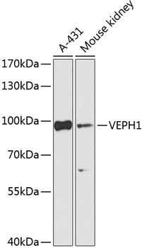 Western blot analysis of extracts of various cell lines, using VEPH1 Antibody (TA383227) at 1:1000 dilution. - Secondary antibody: HRP Goat Anti-Rabbit IgG (H+L) at 1:10000 dilution. - Lysates/proteins: 25ug per lane. - Blocking buffer: 3% nonfat dry milk in TBST. - Detection: ECL Enhanced Kit . - Exposure time: 5s.