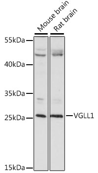 Western blot analysis of extracts of various cell lines, using VGLL1 antibody (TA383230) at 1:1000 dilution. - Secondary antibody: HRP Goat Anti-Rabbit IgG (H+L) at 1:10000 dilution. - Lysates/proteins: 25ug per lane. - Blocking buffer: 3% nonfat dry milk in TBST. - Detection: ECL Basic Kit . - Exposure time: 60s.
