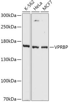 ENO1 Antibody (Cat. #TA324640) western blot analysis in MCF-7, A431, Hela, HepG2, mouse NIH/3T3 cell line and mouse stomach, liver tissue lysates (35 ug/lane).This demonstrates the ENO1 antibody detected the ENO1 protein (arrow).