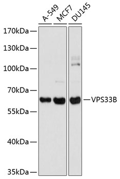 Western blot analysis of extracts of various cell lines, using VPS33B antibody (TA383259) at 1:1000 dilution. - Secondary antibody: HRP Goat Anti-Rabbit IgG (H+L) at 1:10000 dilution. - Lysates/proteins: 25ug per lane. - Blocking buffer: 3% nonfat dry milk in TBST. - Detection: ECL Basic Kit . - Exposure time: 1s.