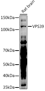 Western blot analysis of extracts of Rat brain, using VPS39 antibody (TA383265) at 1:500 dilution. - Secondary antibody: HRP Goat Anti-Rabbit IgG (H+L) at 1:10000 dilution. - Lysates/proteins: 25ug per lane. - Blocking buffer: 3% nonfat dry milk in TBST. - Detection: ECL Basic Kit . - Exposure time: 180s.
