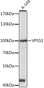 Western blot analysis of extracts of A-549 cells, using VPS51 antibody (TA383268) at 1:1000 dilution. - Secondary antibody: HRP Goat Anti-Rabbit IgG (H+L) at 1:10000 dilution. - Lysates/proteins: 25ug per lane. - Blocking buffer: 3% nonfat dry milk in TBST. - Detection: ECL Basic Kit . - Exposure time: 10s.