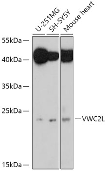 Western blot analysis of extracts of various cell lines, using VWC2L antibody (TA383283) at 1:1000 dilution. - Secondary antibody: HRP Goat Anti-Rabbit IgG (H+L) at 1:10000 dilution. - Lysates/proteins: 25ug per lane. - Blocking buffer: 3% nonfat dry milk in TBST. - Detection: ECL Basic Kit . - Exposure time: 90s.