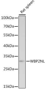 Western blot analysis of extracts of Rat spleen, using WBP2NL Rabbit pAb (TA383292) at 1:1000 dilution. - Secondary antibody: HRP Goat Anti-Rabbit IgG (H+L) at 1:10000 dilution. - Lysates/proteins: 25ug per lane. - Blocking buffer: 3% nonfat dry milk in TBST. - Detection: ECL Basic Kit . - Exposure time: 30s.