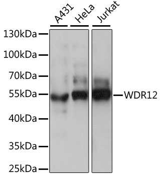 Western blot analysis of P90 RSK1 immuno-precipitated from the mouse brain extract (right) and using RSK1-HRP as a probe. Immuno-precipitated negative control (left).