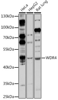 Western blot analysis of extracts of various cell lines, using WDR4 antibody (TA383307) at 1:1000 dilution. - Secondary antibody: HRP Goat Anti-Rabbit IgG (H+L) at 1:10000 dilution. - Lysates/proteins: 25ug per lane. - Blocking buffer: 3% nonfat dry milk in TBST. - Detection: ECL Basic Kit . - Exposure time: 60s.