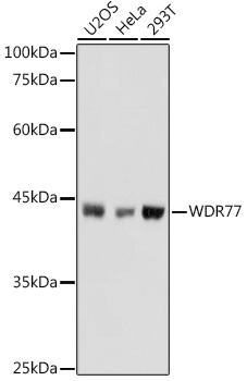 Western blot analysis of Hsp70 in cell lysates from 12 human cancer cell lines at 1:1000 dilution of TA326356.