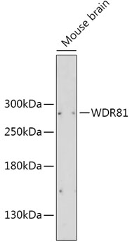 Western Blot analysis of Hsp70/Hsc70 in human cell line lysates at 1:1000 dilution of the antibody