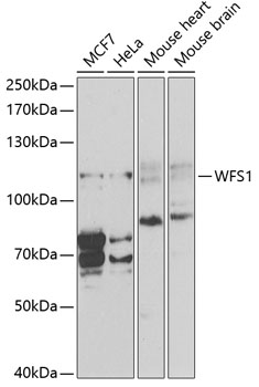 Western blot analysis of Hsp70 in Pam212 cells using a 1:1000 dilution of the antibody