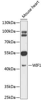Western blot analysis of Hsc70 in a human cell line mix, using a 1:1000 dilution of the antibody
