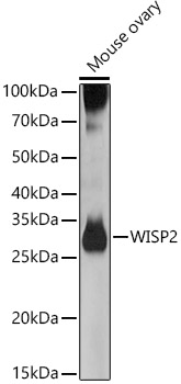 Hsp90 complex isolation (IP) from rabbit retic ulocyte lysate (8D3), SDS PAGE.