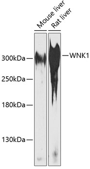 Western blot analysis of Hsp60 in cell lysates from 12 rat tissue lines using a 1:1000 dilution of the antibody