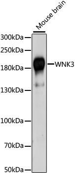Western blot analyis of Hsp60 in HeLa cell lysates using a 1:1000 dilution of the antibody