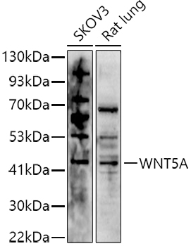 Western blot analysis of Cu/Zn SOD in a human cell line mix, using a 1:1000 dilution of the antibody