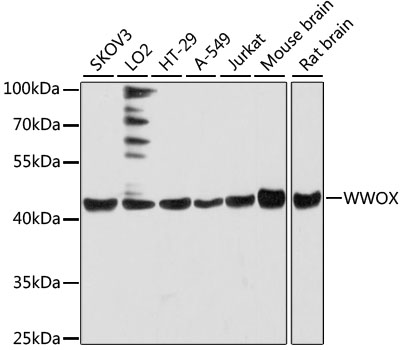 Western blot analysis of Grp94 using Hela cell lysate at 1:1000 dilution of the antibody