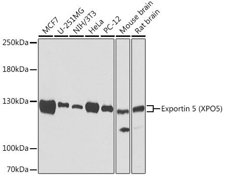 Western blot analysis of extracts of various cell lines, using Exportin 5 (Exportin 5 (XPO5)) antibody (TA383381). - Secondary antibody: HRP Goat Anti-Rabbit IgG (H+L) at 1:10000 dilution. - Lysates/proteins: 25ug per lane. - Blocking buffer: 3% nonfat dry milk in TBST. - Detection: ECL Basic Kit . - Exposure time: 90s.