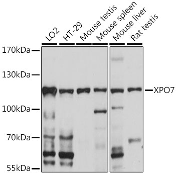 Western blot analysis of extracts of various cell lines, using XPO7 antibody (TA383383) at 1:1000 dilution. - Secondary antibody: HRP Goat Anti-Rabbit IgG (H+L) at 1:10000 dilution. - Lysates/proteins: 25ug per lane. - Blocking buffer: 3% nonfat dry milk in TBST. - Detection: ECL Basic Kit . - Exposure time: 10s.