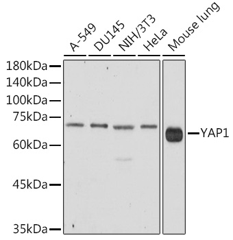 Western blot analysis of HIF1 Alpha in HeLa cell lysates using a 1:500 dilution of the antibody