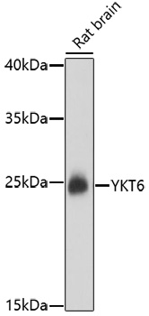 WB of human lysates showing detection of ~60 kDa TCP1-alpha protein using Anti-TCP1, clone 23c. Lane 1: MW ladder. Lane 2: A431 lysate, 20 ug. Lane 3: HEK293 lysate, 20 ug. Block: 5% milk + TBST 1hr at RT. Primary antibody: Rat monoclonal Anti-TCP1-alpha, clone 23c incubated for 60 min at RT. Secondary antibody: Goat Anti-Rat HRP antibody (1:1000) for 60 min at RT. Colour Development: TMB solution for 5 min at RT. Predicted/Observed size: ~60 kDa. Other band (s): ~90 kDa.