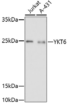 WB of human lysates showing detection of ~60 kDa TCP1-alpha protein using Anti-TCP1, clone 91a. Lane 1: MW ladder. Lane 2: A431 lysate, 20 ug. Lane 3: HEK293 lysate, 20 ug. Block: 5% milk + TBST 1hr at RT. Primary antibody: Rat monoclonal Anti-TCP1-alpha, clone 91a incubated for 60 min at RT. Secondary antibody: Goat Anti-Rat HRP antibody (1:1000) for 60 min at RT. Colour Development: TMB solution for 5 min at RT.