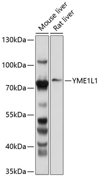 Western blot analysis of extracts of various cell lines, using YME1L1 antibody (TA383412) at 1:1000 dilution. - Secondary antibody: HRP Goat Anti-Rabbit IgG (H+L) at 1:10000 dilution. - Lysates/proteins: 25ug per lane. - Blocking buffer: 3% nonfat dry milk in TBST. - Detection: ECL Basic Kit . - Exposure time: 30s.