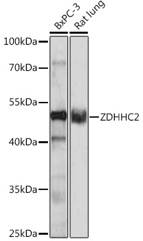 Western blot analysis of extracts of various cell lines, using ZDHHC2 antibody (TA383468) at 1:1000 dilution. - Secondary antibody: HRP Goat Anti-Rabbit IgG (H+L) at 1:10000 dilution. - Lysates/proteins: 25ug per lane. - Blocking buffer: 3% nonfat dry milk in TBST. - Detection: ECL Enhanced Kit . - Exposure time: 90s.