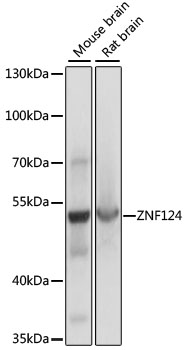 Western blot analysis of extracts of various cell lines, using ZNF124 antibody (TA383513) at 1:1000 dilution. - Secondary antibody: HRP Goat Anti-Rabbit IgG (H+L) at 1:10000 dilution. - Lysates/proteins: 25ug per lane. - Blocking buffer: 3% nonfat dry milk in TBST. - Detection: ECL Basic Kit . - Exposure time: 1s.
