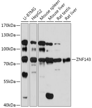 Western blot analysis of extracts of various cell lines, using ZNF143 antibody (TA383517) at 1:1000 dilution. - Secondary antibody: HRP Goat Anti-Rabbit IgG (H+L) at 1:10000 dilution. - Lysates/proteins: 25ug per lane. - Blocking buffer: 3% nonfat dry milk in TBST. - Detection: ECL Basic Kit . - Exposure time: 90s.