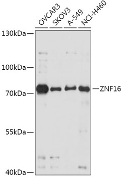 Western blot analysis of extracts of various cell lines, using ZNF16 antibody (TA383520) at 1:1000 dilution. - Secondary antibody: HRP Goat Anti-Rabbit IgG (H+L) at 1:10000 dilution. - Lysates/proteins: 25ug per lane. - Blocking buffer: 3% nonfat dry milk in TBST. - Detection: ECL Basic Kit . - Exposure time: 10s.