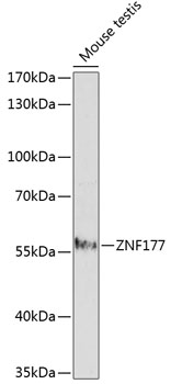 Western blot analysis of extracts of mouse testis, using ZNF177 antibody (TA383523) at 1:1000 dilution. - Secondary antibody: HRP Goat Anti-Rabbit IgG (H+L) at 1:10000 dilution. - Lysates/proteins: 25ug per lane. - Blocking buffer: 3% nonfat dry milk in TBST. - Detection: ECL Enhanced Kit . - Exposure time: 2.5min.