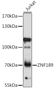 Western blot analysis of extracts of Jurkat cells, using ZNF189 antibody (TA383525) at 1:1000 dilution. - Secondary antibody: HRP Goat Anti-Rabbit IgG (H+L) at 1:10000 dilution. - Lysates/proteins: 25ug per lane. - Blocking buffer: 3% nonfat dry milk in TBST. - Detection: ECL Basic Kit . - Exposure time: 10s.