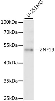 Western blot analysis of extracts of U-251MG cells, using ZNF19 antibody (TA383526) at 1:1000 dilution. - Secondary antibody: HRP Goat Anti-Rabbit IgG (H+L) at 1:10000 dilution. - Lysates/proteins: 25ug per lane. - Blocking buffer: 3% nonfat dry milk in TBST. - Detection: ECL Basic Kit . - Exposure time: 5s.