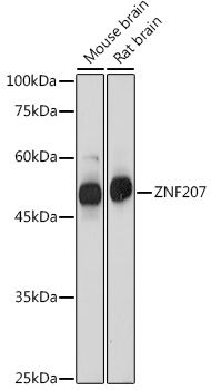 Western blot analysis of extracts of various cell lines, using ZNF207 antibody (TA383531) at 1:1000 dilution. - Secondary antibody: HRP Goat Anti-Rabbit IgG (H+L) at 1:10000 dilution. - Lysates/proteins: 25ug per lane. - Blocking buffer: 3% nonfat dry milk in TBST. - Detection: ECL Basic Kit . - Exposure time: 1s.