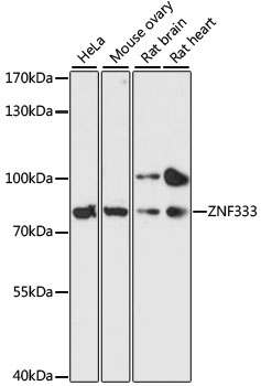 Western blot analysis of extracts of various cell lines, using ZNF333 antibody (TA383552) at 1:3000 dilution. - Secondary antibody: HRP Goat Anti-Rabbit IgG (H+L) at 1:10000 dilution. - Lysates/proteins: 25ug per lane. - Blocking buffer: 3% nonfat dry milk in TBST. - Detection: ECL Basic Kit . - Exposure time: 90s.