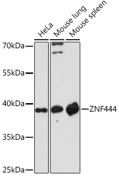 Western blot analysis of extracts of various cell lines, using ZNF444 Rabbit pAb (TA383565) at 1:1000 dilution. - Secondary antibody: HRP Goat Anti-Rabbit IgG (H+L) at 1:10000 dilution. - Lysates/proteins: 25ug per lane. - Blocking buffer: 3% nonfat dry milk in TBST. - Detection: ECL Enhanced Kit . - Exposure time: 90s.