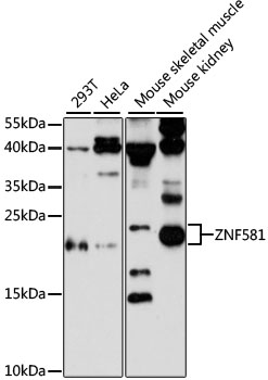 Western blot analysis of extracts of various cell lines, using ZNF581 antibody (TA383585) at 1:3000 dilution. - Secondary antibody: HRP Goat Anti-Rabbit IgG (H+L) at 1:10000 dilution. - Lysates/proteins: 25ug per lane. - Blocking buffer: 3% nonfat dry milk in TBST. - Detection: ECL Enhanced Kit . - Exposure time: 90s.