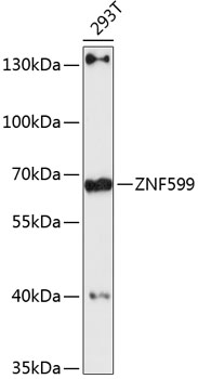 Western blot analysis of recombinant human TIMP-2 protein using anti-TIMP-2, clone F27P3A4.