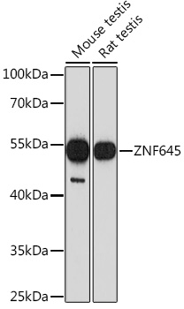 Western blot analysis of extract from Hela cells using anti-ATIC, clone F38P7H9.